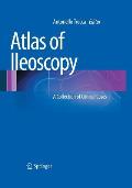 Atlas of Ileoscopy: A Collection of Clinical Cases