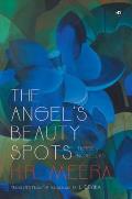 The Angel's Beauty Spots