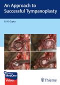 An Approach to Successful Tympanoplasty