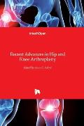 Recent Advances in Hip and Knee Arthroplasty