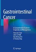 Gastrointestinal Cancer: A Comprehensive Guide to Diagnosis and Management