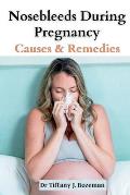 Nosebleeds During Pregnancy: Causes and Remedies