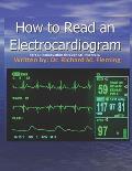 How to Read an Electrocardiogram.