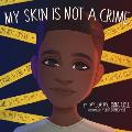 My Skin Is Not A Crime